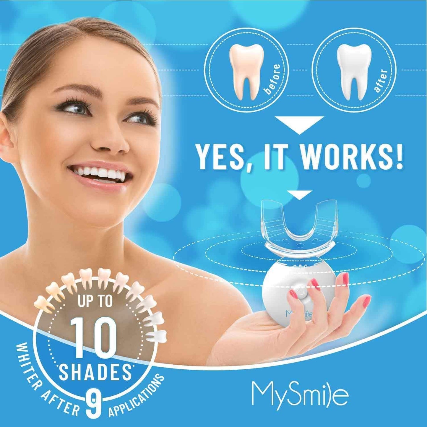 MySmile LED Whitening Kit - 10 Min Treatment, 3 Gel Syringes