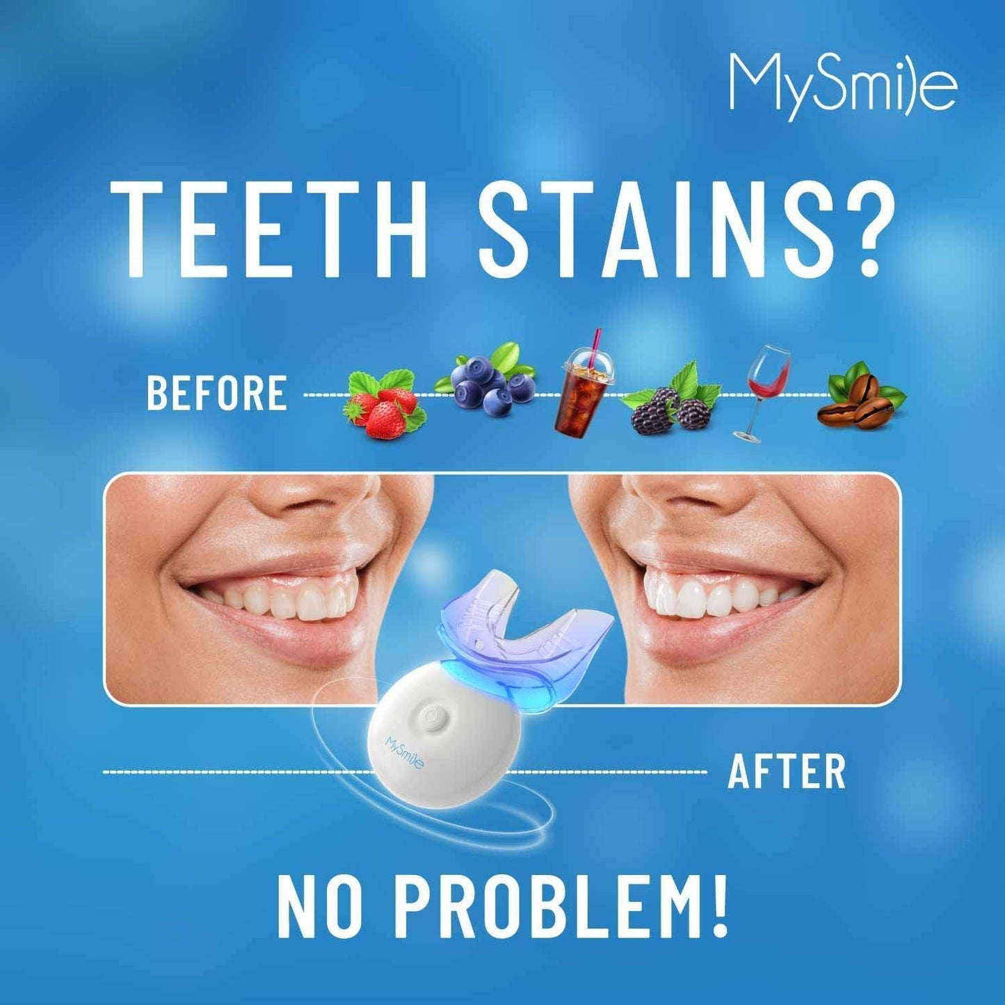 MySmile LED Whitening Kit - 10 Min Treatment, 3 Gel Syringes