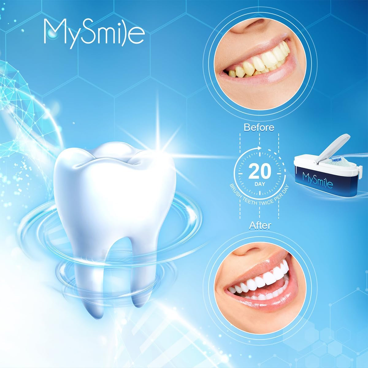 MySmile Teeth Whitener - Non-Toxic Whitening Powder for Sensitive Teeth